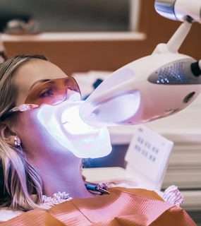 Bleaching bei Ihrem Experten in Köln