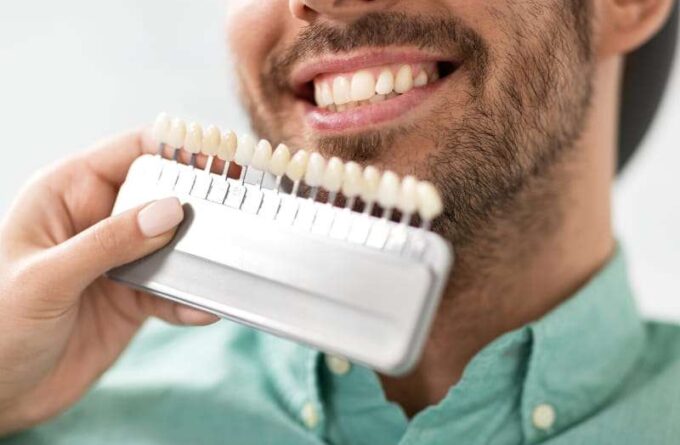 Bleaching ist eine Leistung im Bereich Zahnästhetik unserer Praxis in Köln.