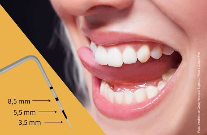 Frau fühlt mit der Zunge über die eigenen Zähne